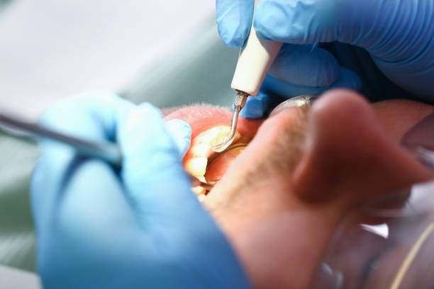 Best Emergency Tooth Extraction  in Gibraltar, MI