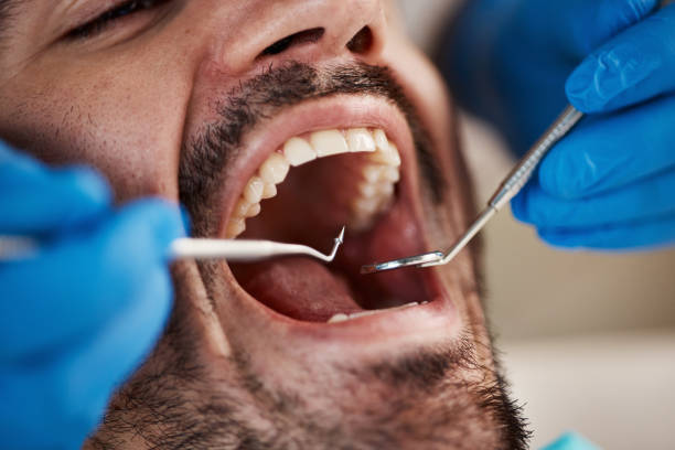 Best Knocked-Out Tooth Emergency  in Gibraltar, MI